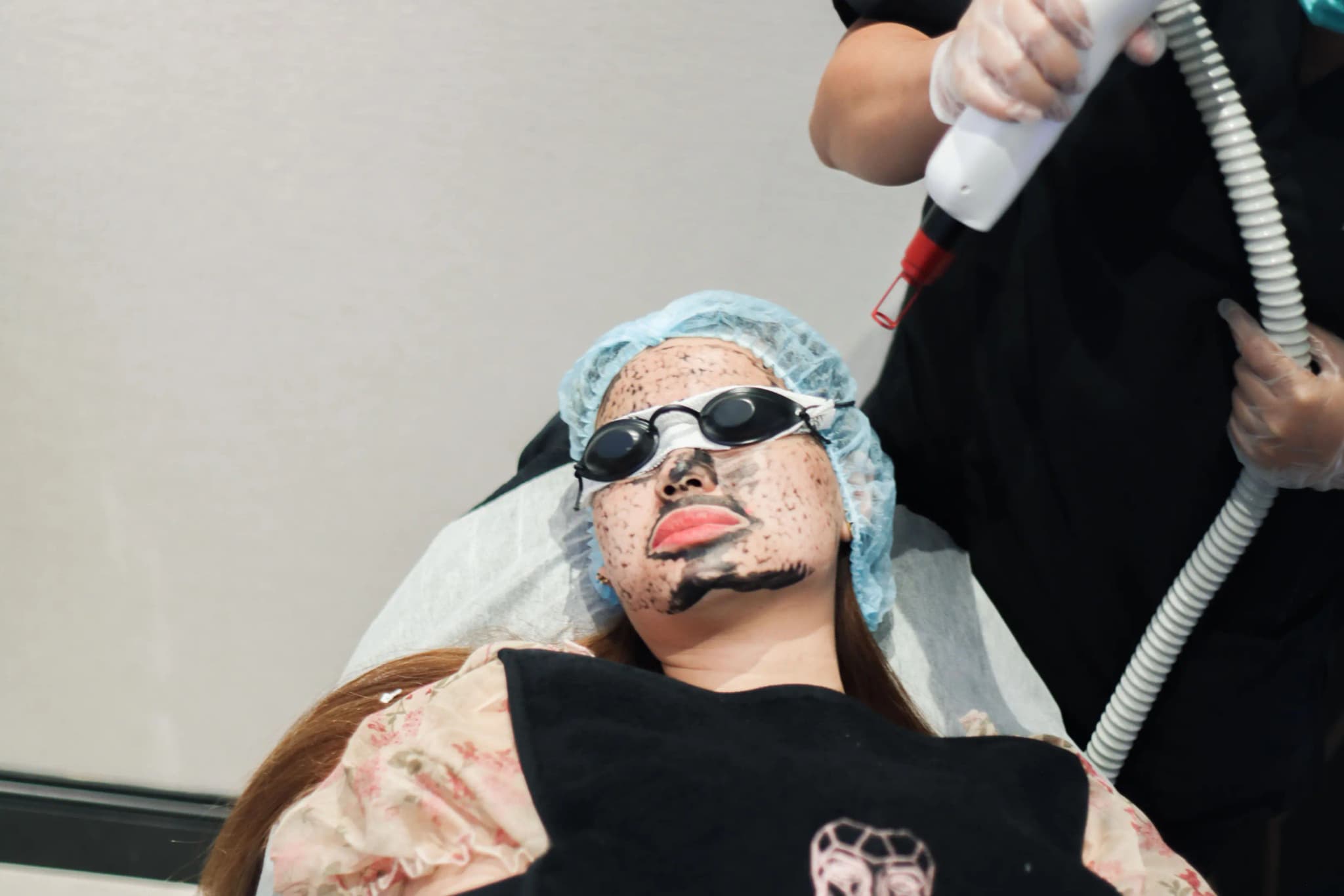 Pigmentierung & Dunkle Flecken - ICONIQUE Treatment Category