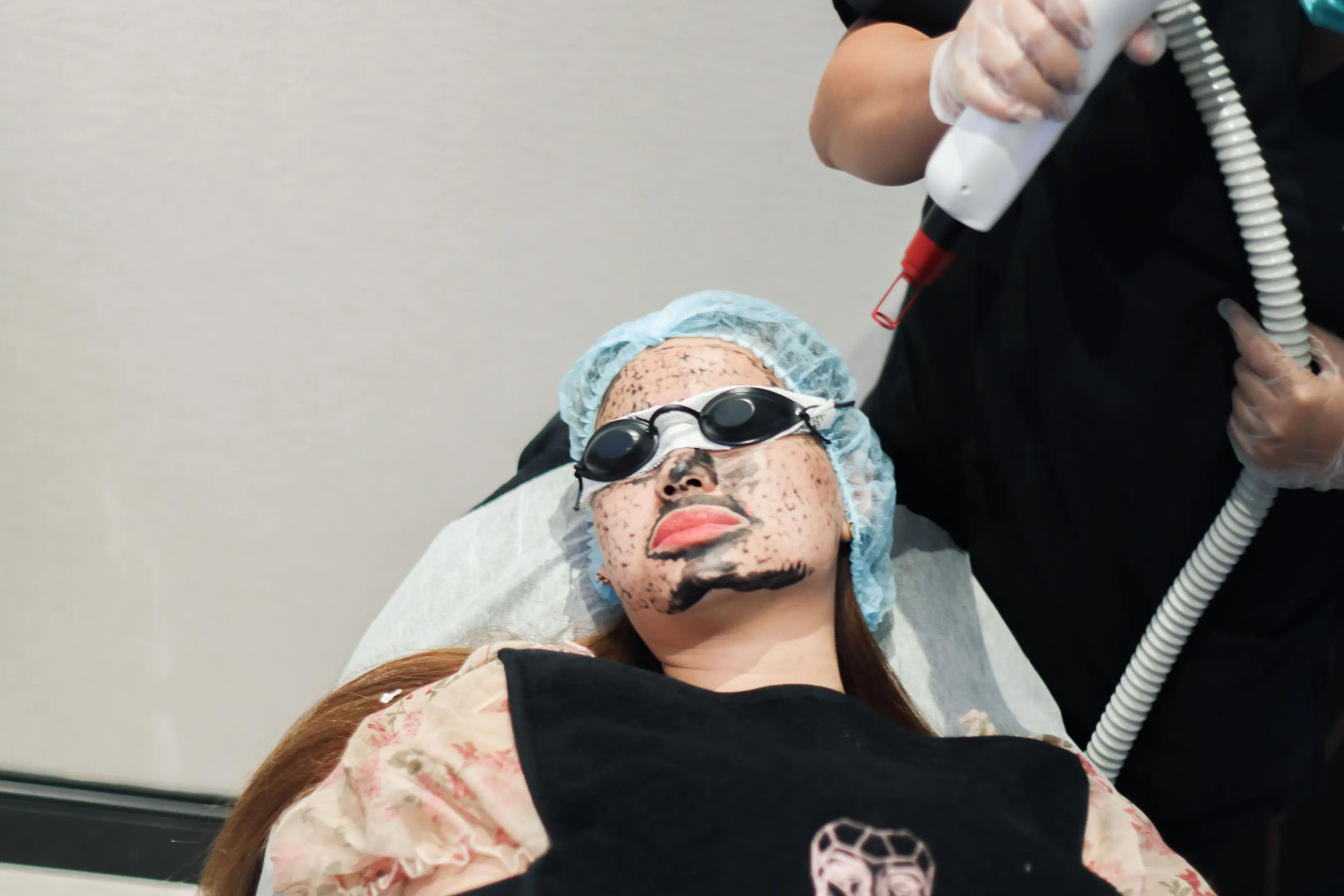 Pigmentierung & Dunkle Flecken - ICONIQUE Treatment Category